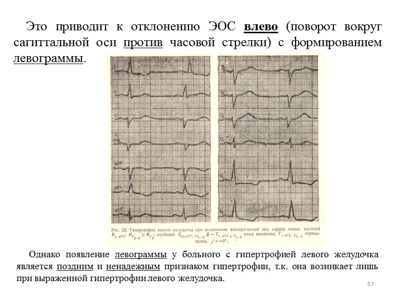 57 Это приводит к отклонению ЭОС влево (поворот вокруг 57 Это приводит к отклонению ЭОС влево (поворот вокруг